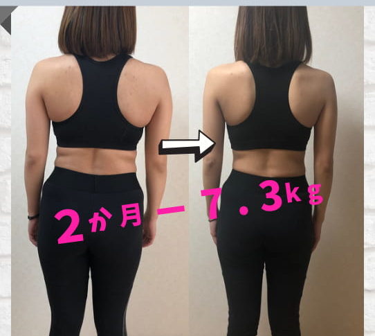 VISILビフォーアフター (1)-4