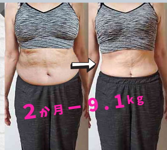 VISILビフォーアフターのコピー (14)-1