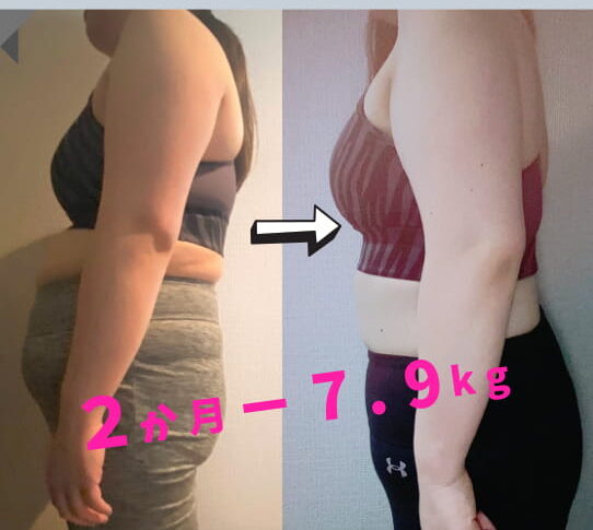 VISILビフォーアフターのコピー (16)-1