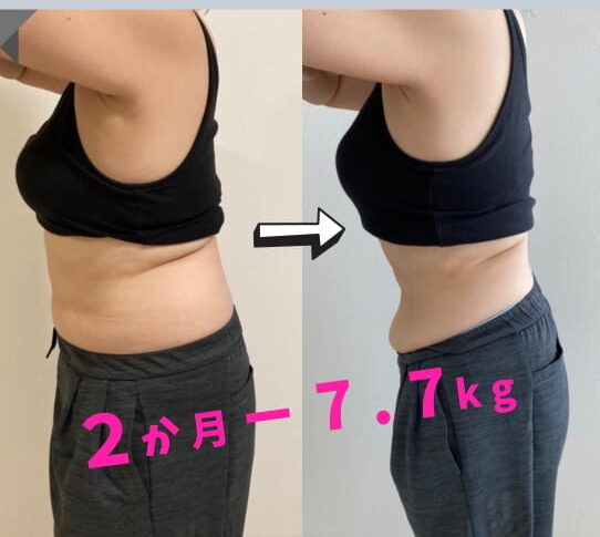 VISILビフォーアフターのコピー (22)-1